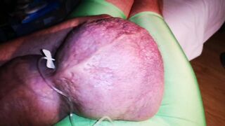 The 3th Liter Glucose